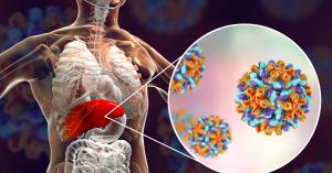 تعرف على خفايا الإصابة بمرض التهاب الكبد الوبائي